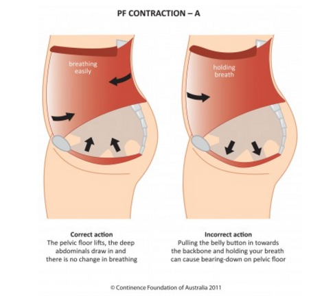 Returning to running after childbirth Unity Studios Uniting